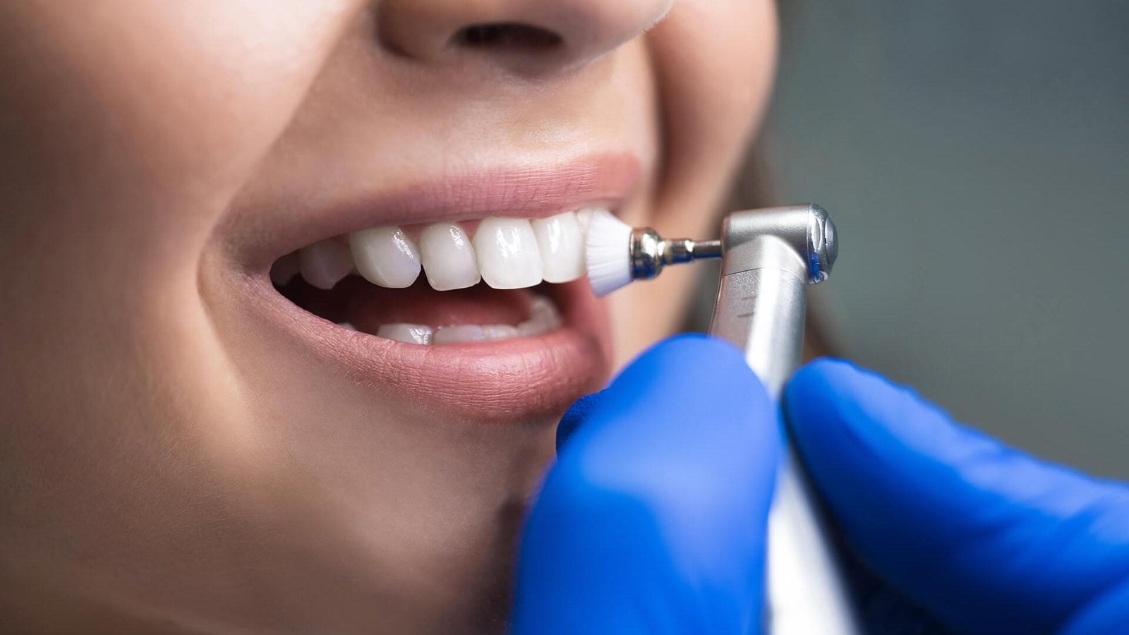 Oral hygiene checkup